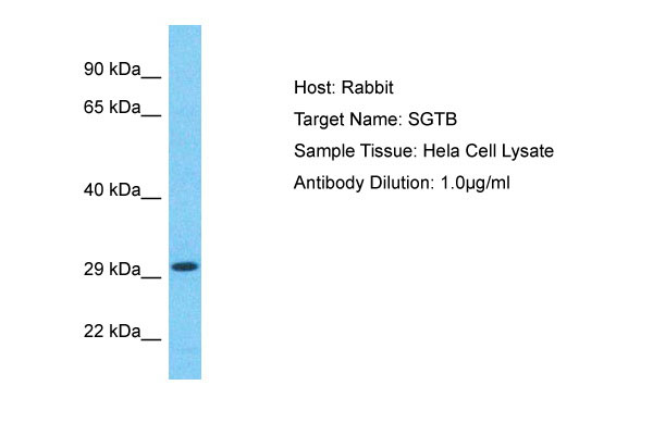 1 - SGTB Antibody - N-terminal region AI15410