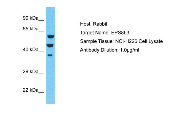1 - EPS8L3 Antibody - middle region AI15429