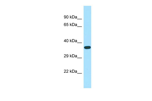 1 - ASB14 Antibody - N-terminal region AI15475