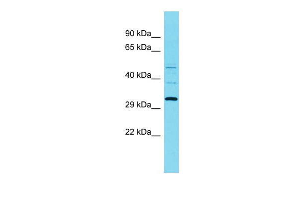 1 - RGD1309748 Antibody - C-terminal region AI15576