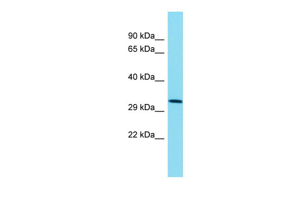1 - TMEM241 Antibody - C-terminal region AI15702