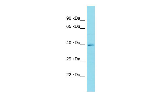 1 - FRMD6-AS1 Antibody - C-terminal region AI15736