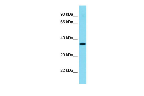 1 - C1orf168 Antibody - N-terminal region AI15747