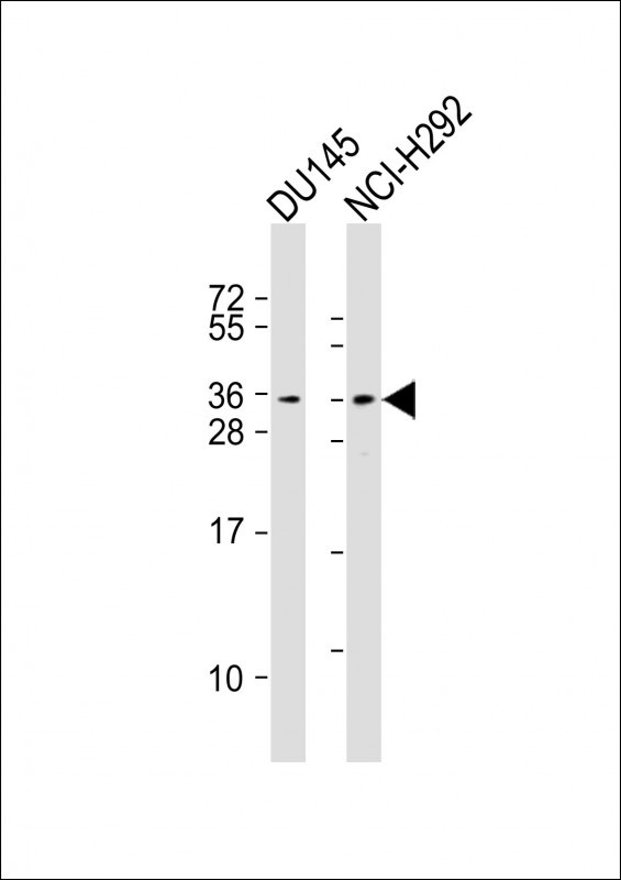 1 - TSPAN18 Antibody (Center) AP18147c