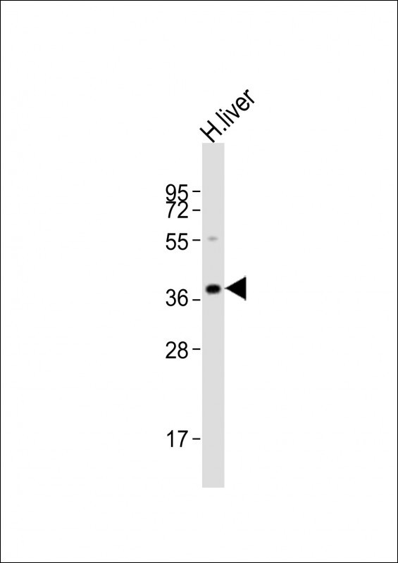 1 - LMX1A Antibody (C-term) AP21429b