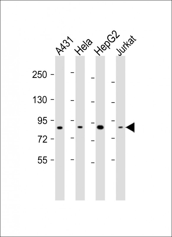1 - NEK10 Antibody (Center) AP21574c