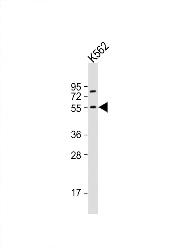 1 - NAGS Antibody (C-term) AP21612b