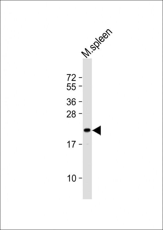 1 - SEC11C Antibody (Center) AP21629c