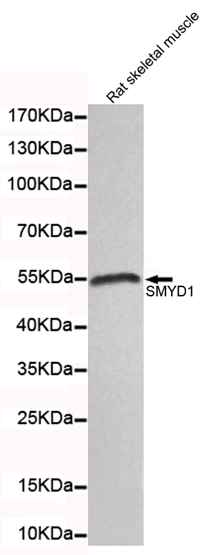 1 - SMYD1 Antibody AP52666