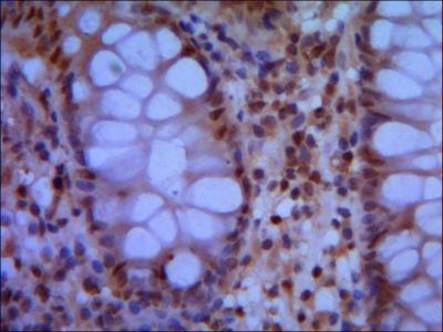 2 - SMC1A (N-terminus) Antibody AP52667