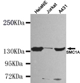 1 - SMC1A (N-terminus) Antibody AP52667