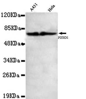 1 - FOXO1 (C-terminus) Antibody AP52712