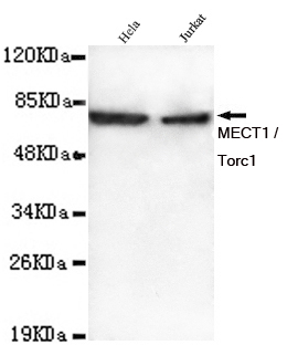 1 - MECT1 / Torc1 Antibody AP52722