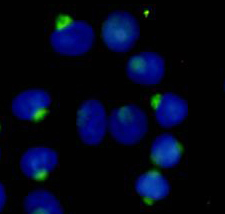 8 - RanBP9 Antibody AP52736