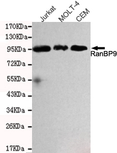 1 - RanBP9 Antibody AP52736