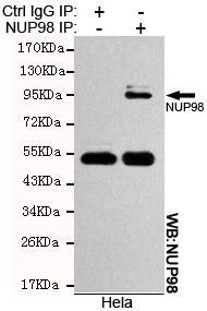 5 - NUP98 Antibody AP52748