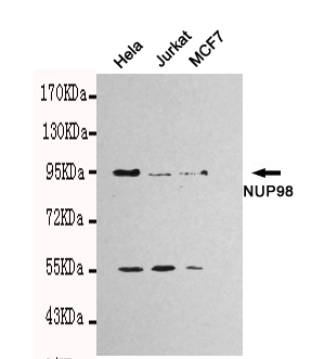 1 - NUP98 Antibody AP52748