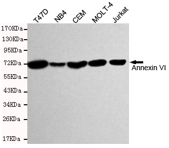 1 - Annexin VI Antibody AP52784