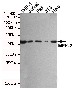 1 - Rabbit IgG Antibody AP52845