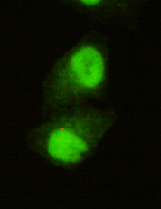 8 - KDM5C / Jarid1C / SMCX Antibody AP53266