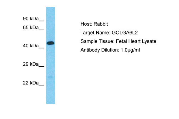 1 - GOLGA6L2 Antibody - middle region AI15843