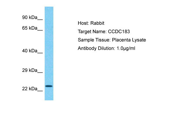 1 - CCDC183 Antibody - N-terminal region AI15867