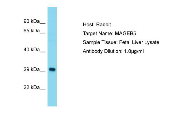 1 - MAGEB5 Antibody - N-terminal region AI15880