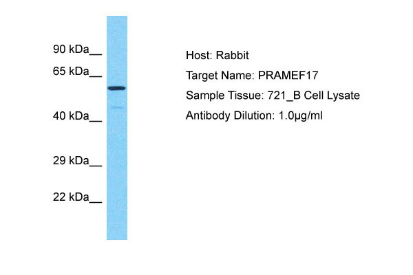 1 - PRAMEF17 Antibody - N-terminal region AI15959