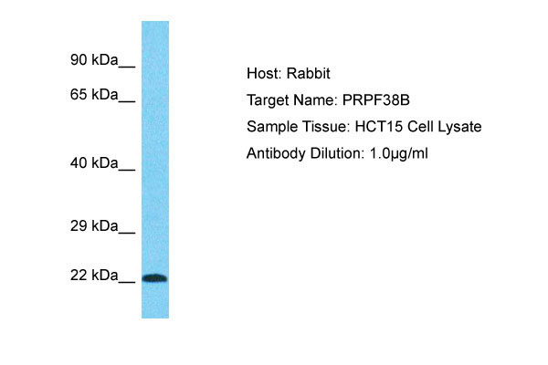 1 - PRPF38B Antibody - middle region AI15960