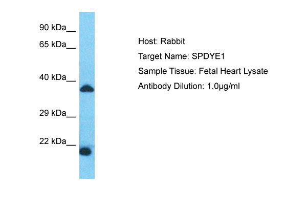 1 - SPDYE1 Antibody - N-terminal region AI15974