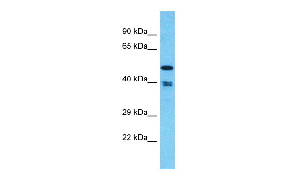 1 - THUMPD1 Antibody - C-terminal region AI15979