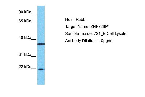 1 - ZNF726P1 Antibody - N-terminal region AI16027