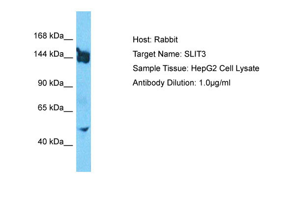 1 - SLIT3 Antibody - N-terminal region AI16030
