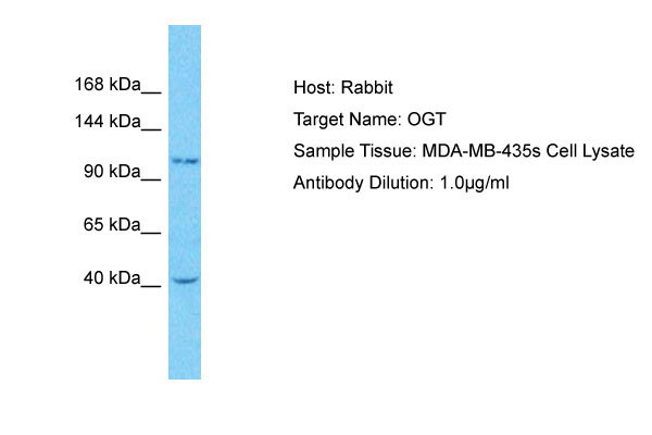1 - OGT Antibody - N-terminal region AI16035