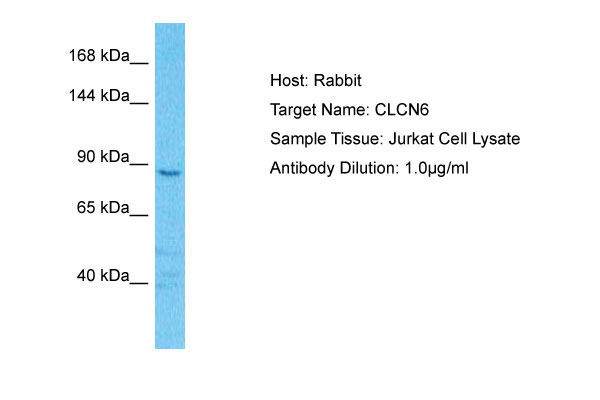 1 - CLCN6 Antibody - C-terminal region AI16098