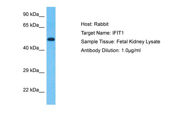 1 - IFIT1 Antibody - C-terminal region AI16108