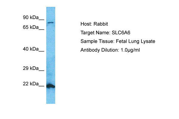 1 - SC6A6 Antibody - N-terminal region AI16128