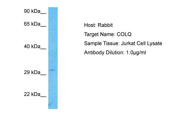 1 - COLQ Antibody - C-terminal region AI16146