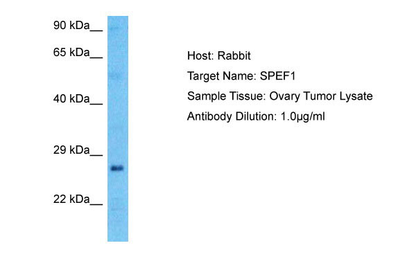1 - SPEF1 Antibody - N-terminal region AI16160