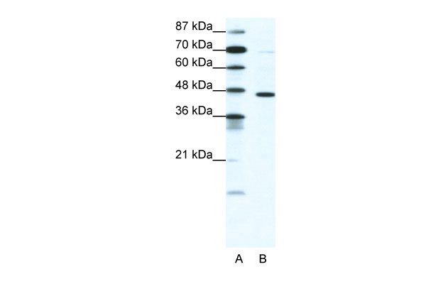 1 - GABRP antibody - N-terminal region AI16206
