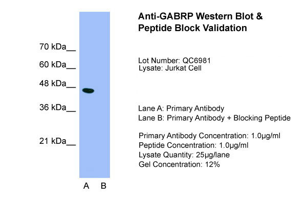 1 - GABRP antibody - N-terminal region AI16206