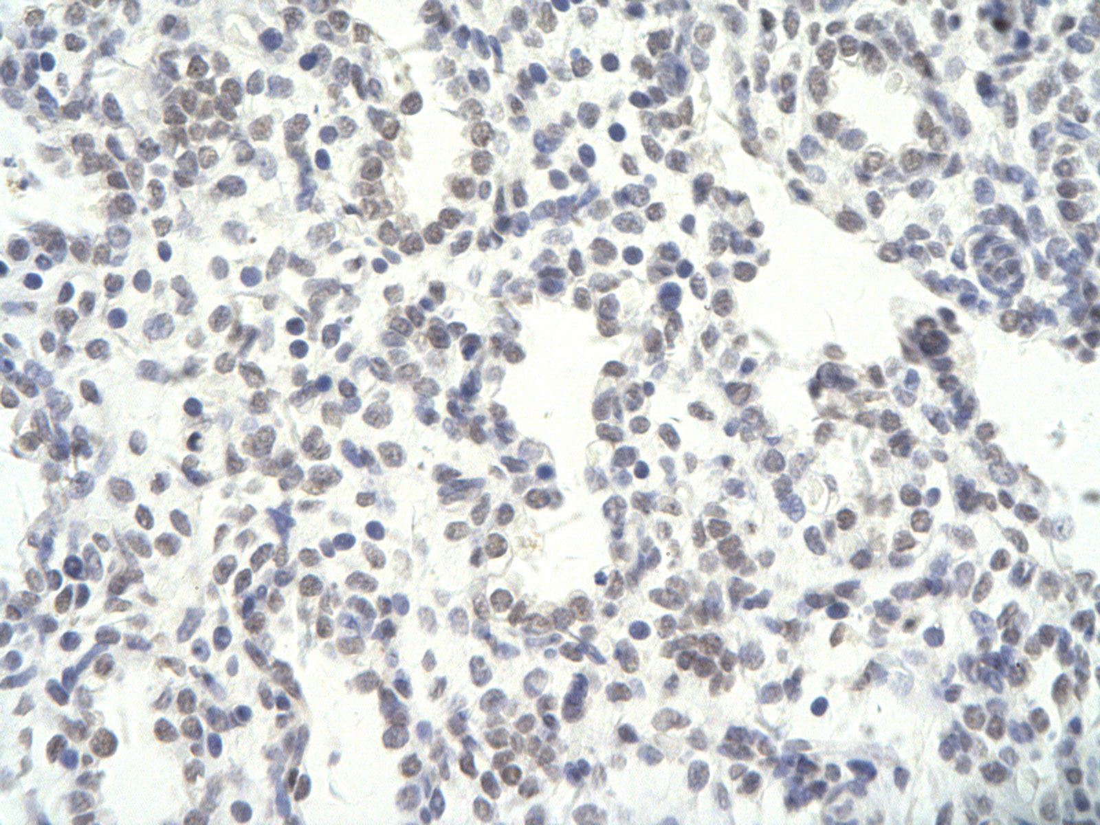 2 - NFYC antibody - C-terminal region AI16229