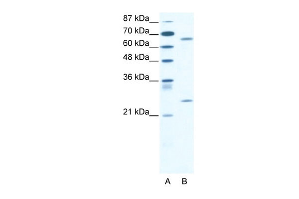 1 - FOXK2 antibody - C-terminal region AI16241