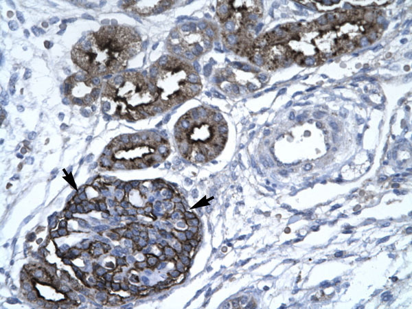 2 - GABPA antibody - C-terminal region AI16246