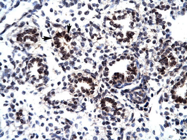 2 - GABPB2 antibody - C-terminal region AI16262