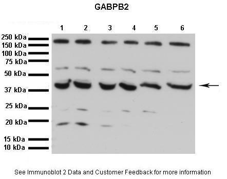 1 - GABPB2 antibody - C-terminal region AI16262