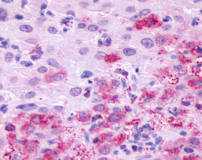 2 - LHCGR / LHR / LH Receptor Antibody (C-Terminus) ALS10362