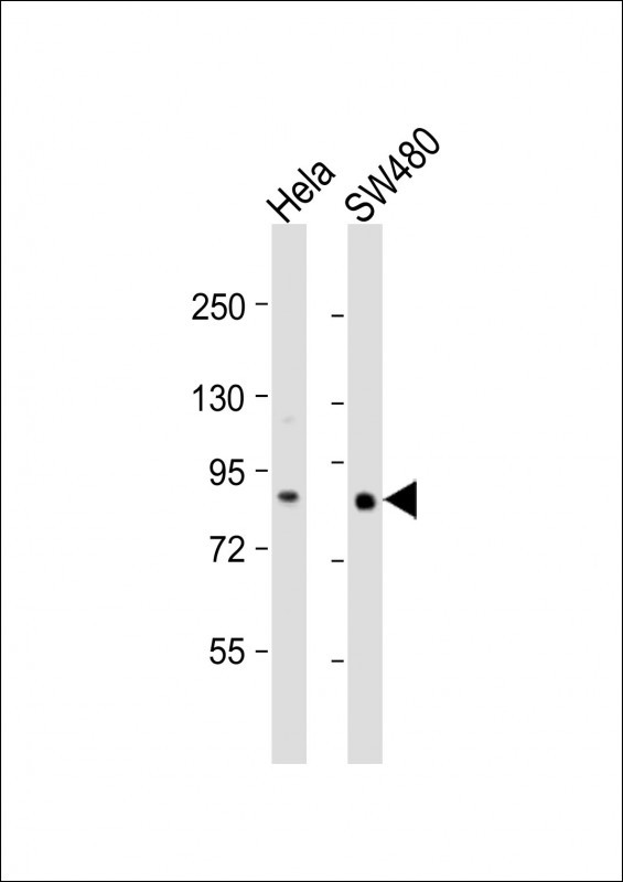 1 - SLCO1B3 Antibody (C-term) AP18964b