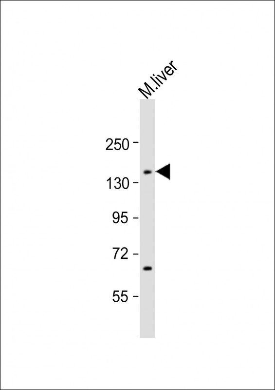 1 - Mouse Lmtk3 Antibody (Center) AP21694c
