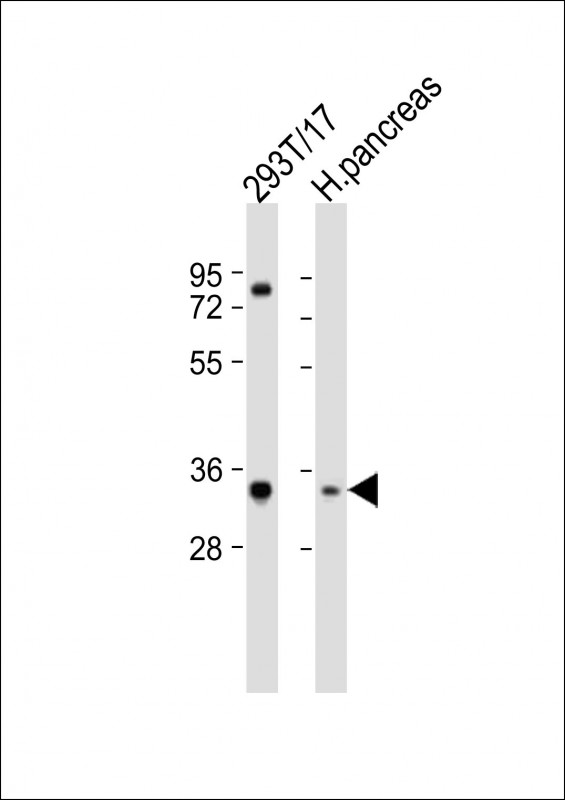 1 - SHOX Antibody (N-term) AP21698a